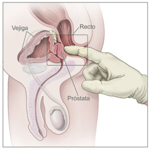 masturbación prostática pegging